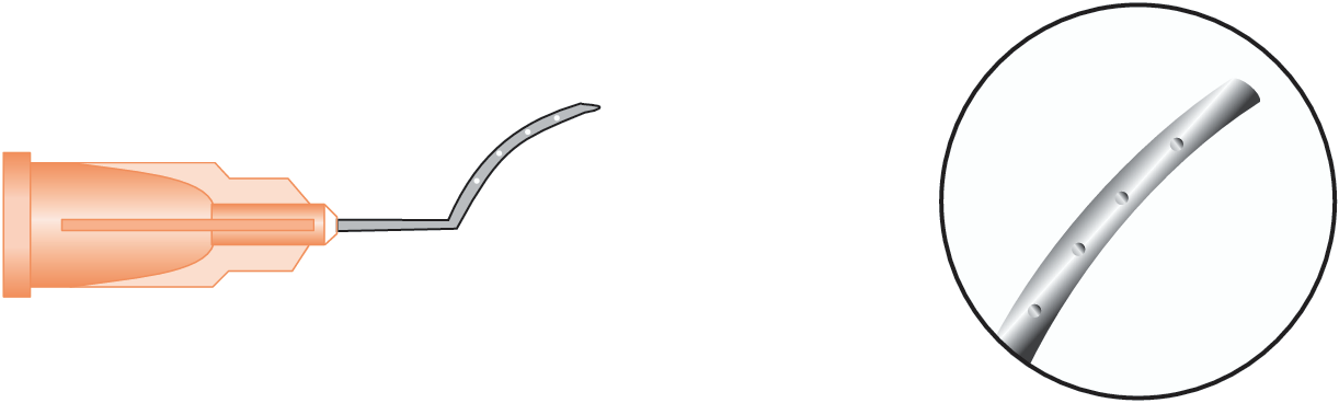 Lasik Irrigating Cannula (Banaji)